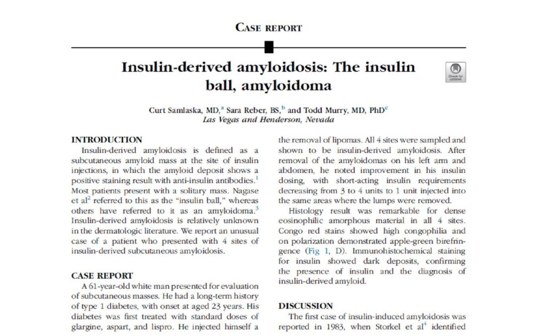 Insulin-Derived Amyloidosis, The Insulin Ball, Amyloidoma:  A Closer Look…