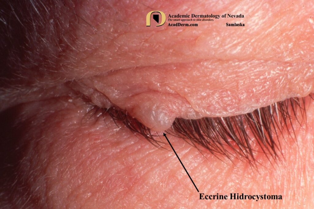 EH3Samlaska - Academic Dermatology of Nevada