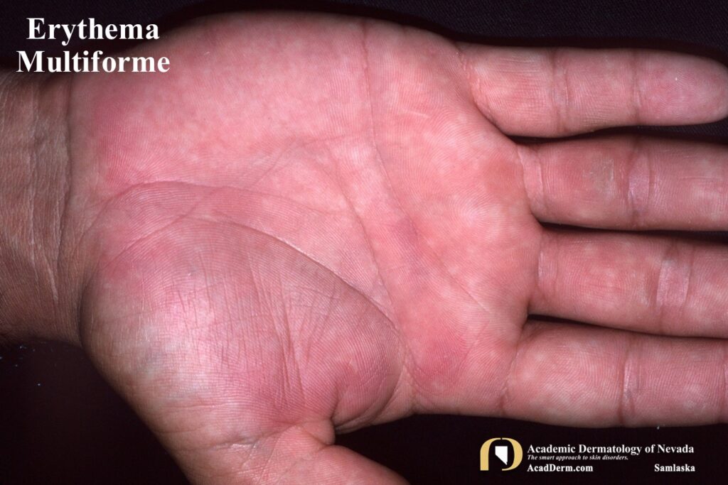 EM3Samlaska - Academic Dermatology of Nevada