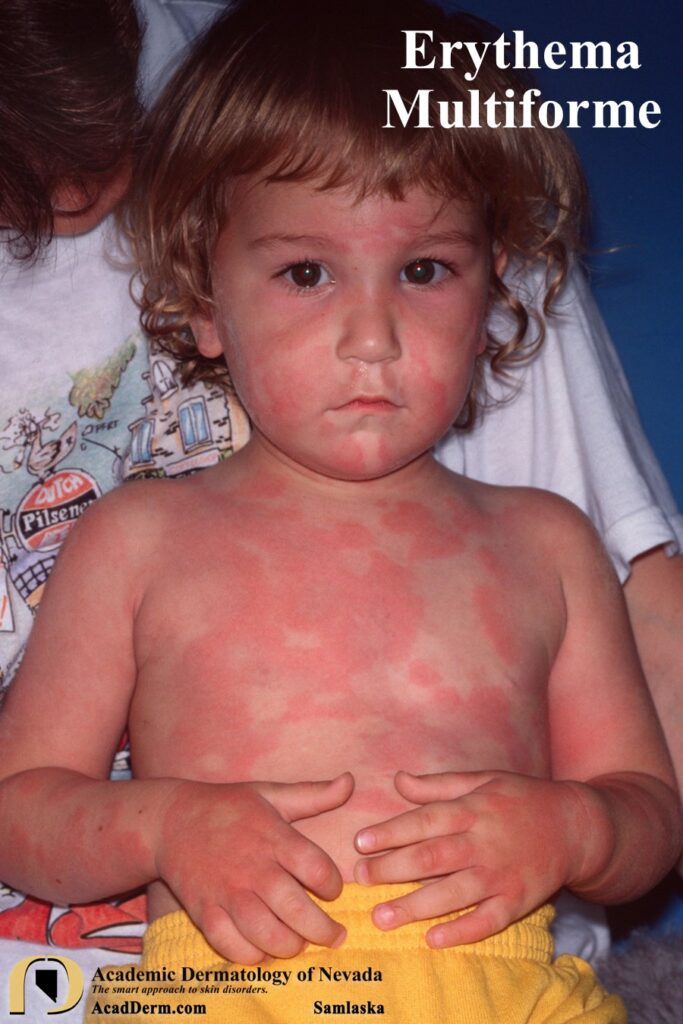 EM6Samlaska - Academic Dermatology of Nevada