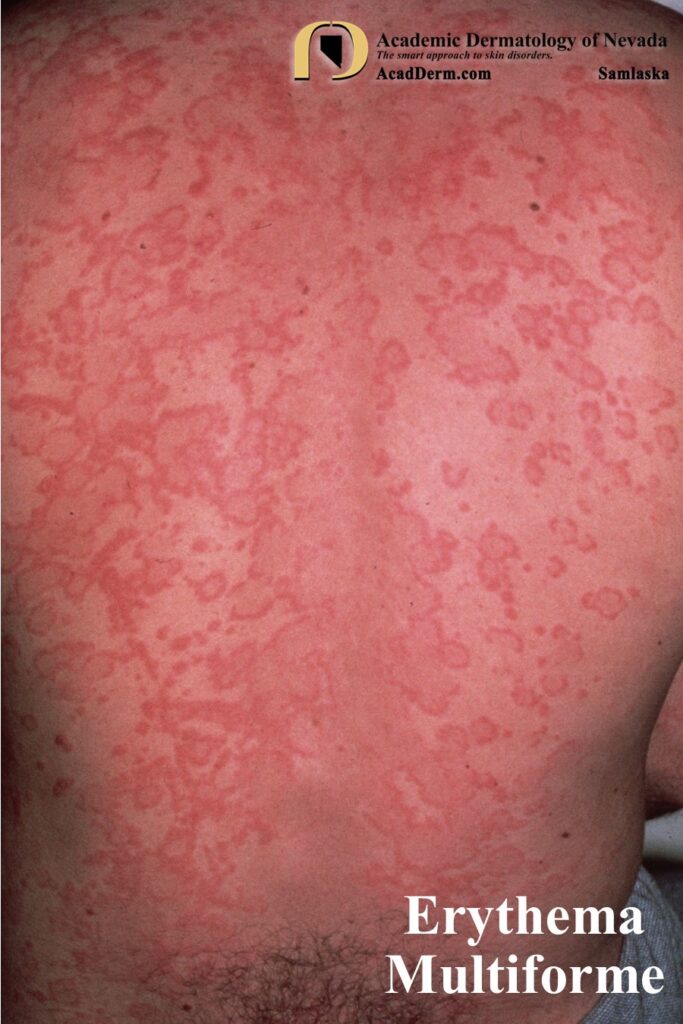 EM8Samlaska - Academic Dermatology of Nevada