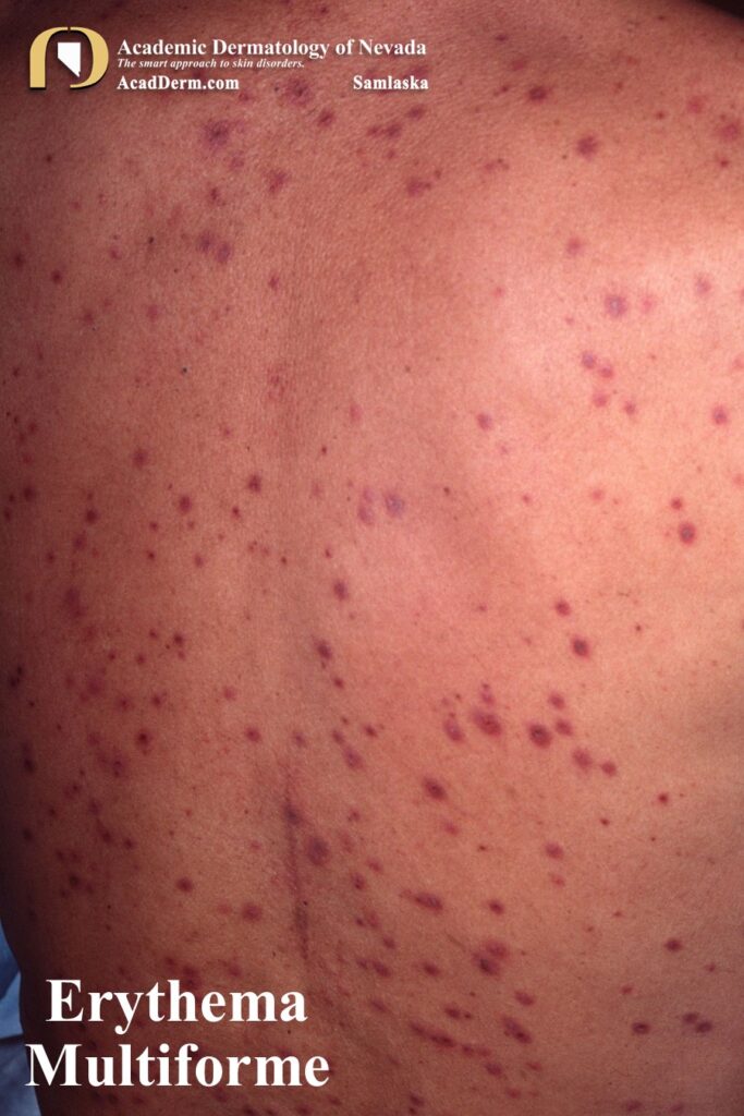 EM9Samlaska - Academic Dermatology of Nevada