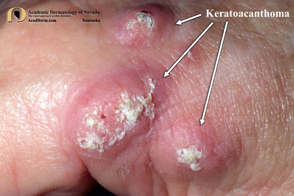 KA2Samlaska - Academic Dermatology of Nevada