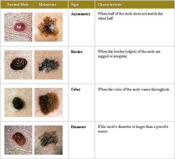 ABCDChart - Academic Dermatology of Nevada - Academic Dermatology of Nevada