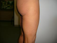 Cosmetic-Dermatology-Services-element87 - Academic Dermatology of Nevada - Academic Dermatology of Nevada